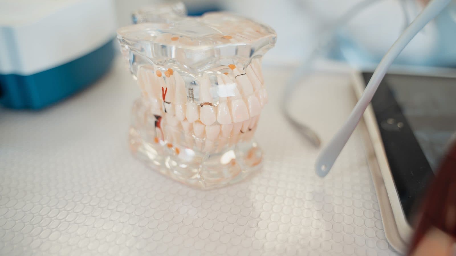 Choosing the Right Dentist: Insights from Dr. James Willis, DDS