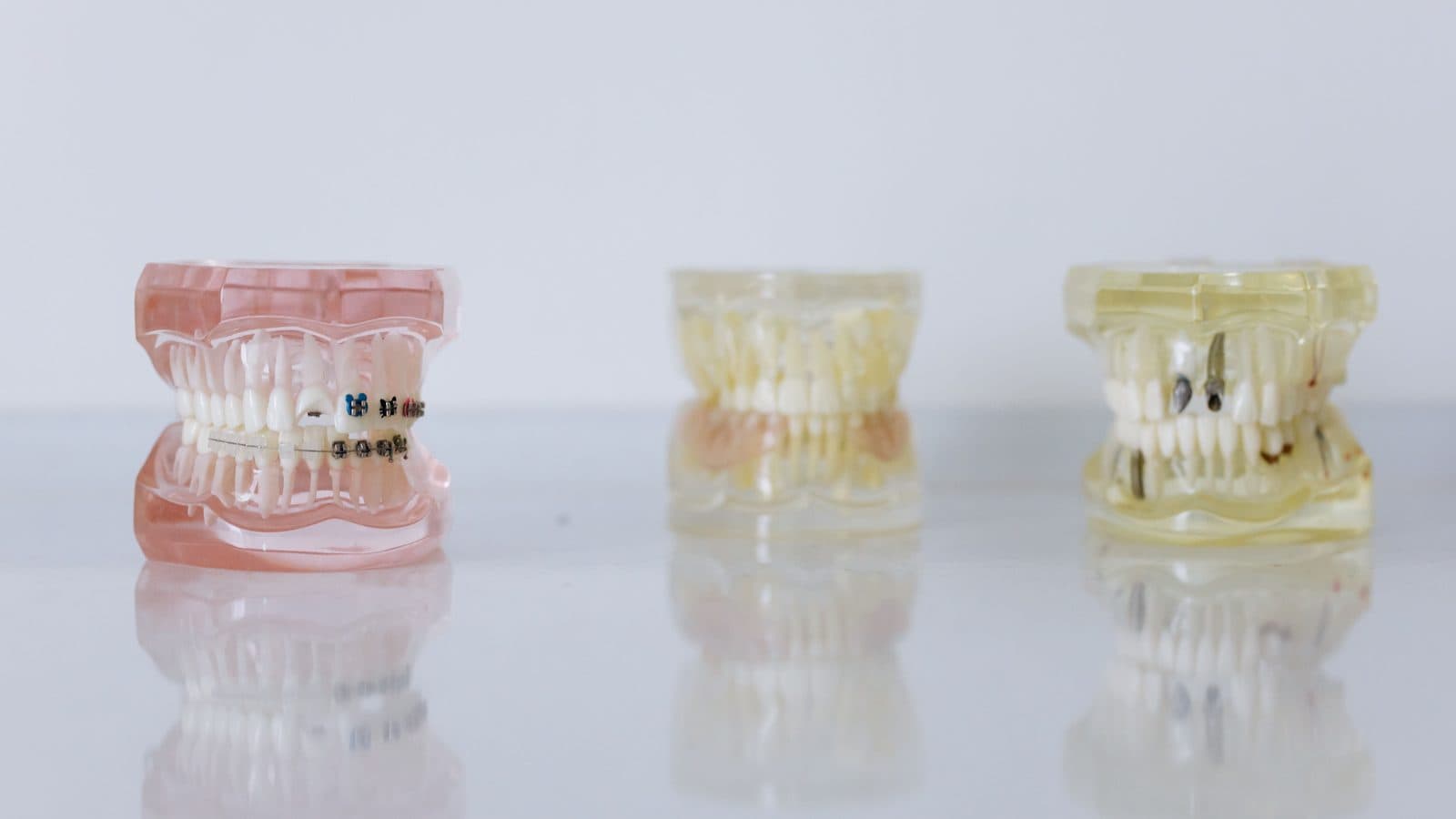 Finding Your Smile Ally: Choosing the Right Dentist for National Align Your Teeth Day