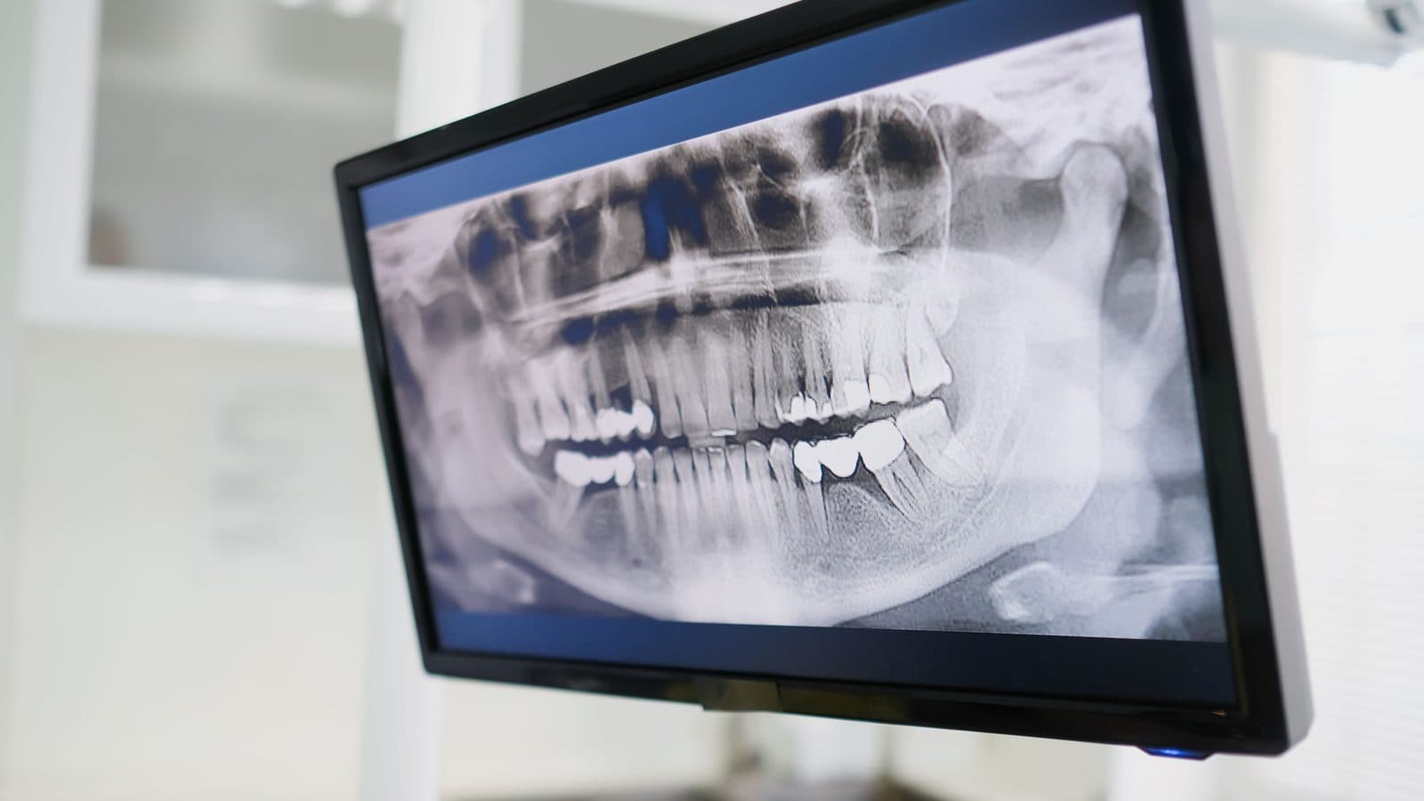 Embracing the Future of Dentistry: How Technology Enhances Oral Health in 2024